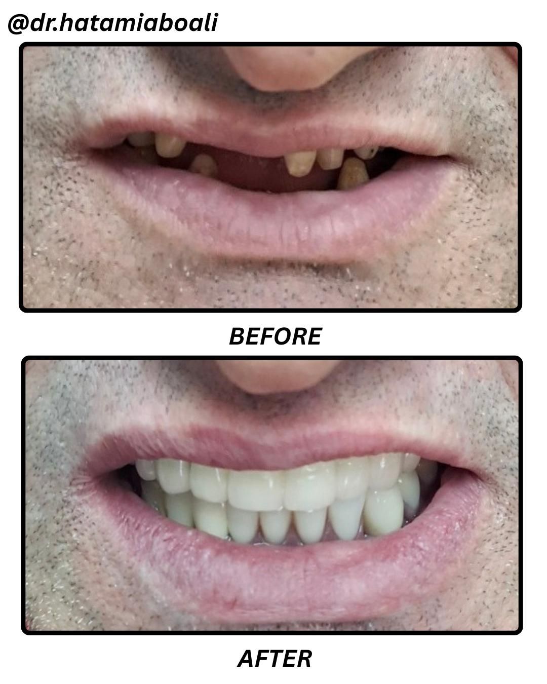 Caz 3 - Before & After